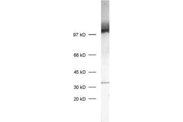 SV2C antibody