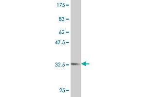 Western Blot detection against Immunogen (34. (ZIC1 antibody  (AA 139-212))