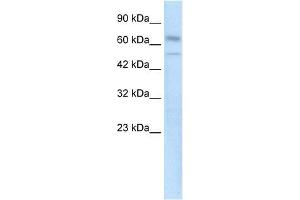 Human kidney; WB Suggested Anti-ZNF306 Antibody Titration: 0. (ZKSCAN3 antibody  (N-Term))