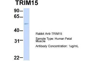 Host: Rabbit  Target Name: TRIM15  Sample Tissue: Human Fetal Muscle  Antibody Dilution: 1. (TRIM15 antibody  (Middle Region))