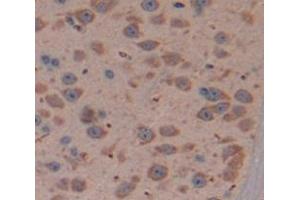 IHC-P analysis of Mouse Tissue, with DAB staining. (DIXDC1 antibody  (AA 513-711))