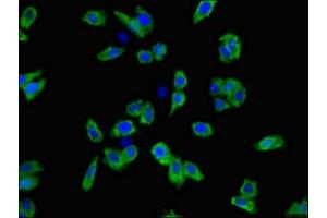 Immunofluorescent analysis of HepG2 cells using ABIN7169976 at dilution of 1:100 and Alexa Fluor 488-congugated AffiniPure Goat Anti-Rabbit IgG(H+L) (SLC6A3 antibody  (AA 161-237))
