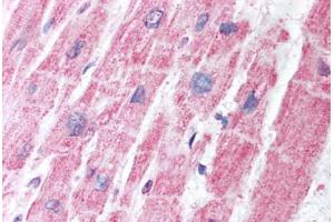 Human Heart (formalin-fixed, paraffin-embedded) stained with MDH1 antibody ABIN291679 at 5 ug/ml followed by biotinylated secondary antibody, alkaline phosphatase-streptavidin and chromogen. (MDH1 antibody)