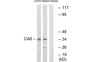 Western blot analysis of extracts from LOVO cells and HepG2 cells, using CA6 antibody. (CA6 antibody  (C-Term))