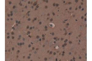 Immunohistochemistry (IHC) image for anti-X-Ray Repair Complementing Defective Repair in Chinese Hamster Cells 6 (XRCC6) (AA 319-538) antibody (ABIN7431623)