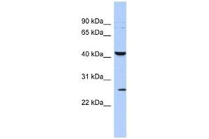 KCNMB4 antibody used at 1 ug/ml to detect target protein. (KCNMB4 antibody  (Middle Region))