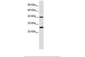 Image no. 1 for anti-Proteasome (Prosome, Macropain) 26S Subunit, Non-ATPase, 4 (Psmd4) (AA 92-141) antibody (ABIN202377) (PSMD4/ASF antibody  (AA 92-141))