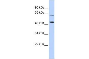 WB Suggested Anti-C5orf33 Antibody Titration: 0. (NADK2 antibody  (Middle Region))