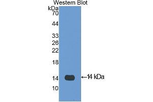 Western blot analysis of the recombinant protein. (PF4 antibody  (AA 30-105))