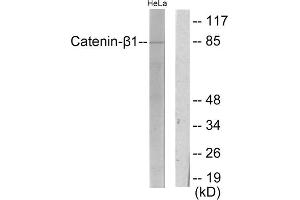 Western blot analysis of extracts from HeLa cells, using Catenin- beta 1 antibody. (CTNNB1 antibody  (C-Term))