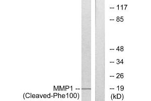 Western blot analysis of extracts from 549 cells, treated with etoposide (25uM, 24hours), using MMP1 (Cleaved-Phe100) antibody. (MMP1 antibody  (Cleaved-Phe100))