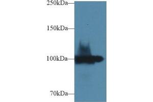 Western Blot; Sample: Rat Kidney lysate; Primary Ab: 1µg/ml Rabbit Anti-Rat ENPP1 Antibody Second Ab: 0. (ENPP1 antibody  (AA 568-793))