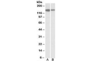 Western blot testing of Jurkat [A] and human thymus [B] lysates with MCF2L antibody at 1ug/ml. (MCF2L antibody)