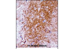 Immunohistochemistry (Paraffin-embedded Sections) (IHC (p)) image for anti-Neurotrophic Tyrosine Kinase, Receptor, Type 2 (NTRK2) (AA 343-372) antibody (ABIN657851)