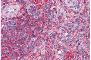 Immunohistochemistry (Formalin-fixed Paraffin-embedded Sections) (IHC (fp)) image for anti-Synaptosomal-Associated Protein, 23kDa (SNAP23) (AA 1-132) antibody (ABIN604929)
