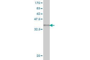 Western Blot detection against Immunogen (37. (ZNF281 antibody  (AA 787-893))