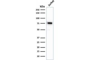 Western Blot Analysis of human Jurkat cell lysate using Moesin Mouse Recombinant Monoclonal Antibody (rMSN/492). (Recombinant Moesin antibody)