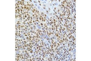 Immunohistochemistry of paraffin-embedded human tonsil using T Rabbit mAb (ABIN7270715) at dilution of 1:25 (40x lens).