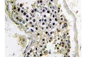Immunohistochemistry (IHC) analyzes of Gαt2 antibody in paraffin-embedded human testis tissue.