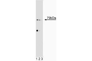 Western blot analysis of 5-Lipoxygenase on SL-29 lysate. (ALOX5 antibody  (AA 442-590))