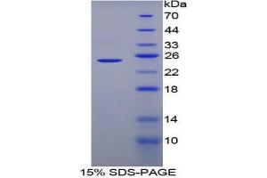 SDS-PAGE analysis of Mouse Adenylate Cyclase 6 Protein. (ADCY6 Protein)