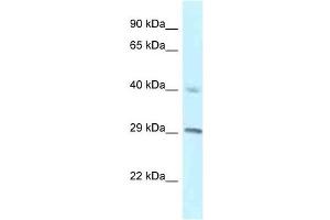 Western Blot showing RCC1 antibody used at a concentration of 1 ug/ml against NCI-H226 Cell Lysate (RCC1 antibody  (C-Term))