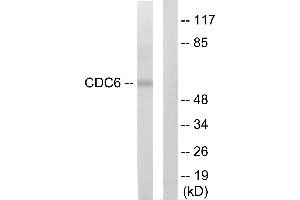 Western blot analysis of extracts from K562 cells, using CDC6 antibody. (CDC6 antibody)