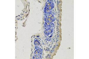Immunohistochemistry of paraffin-embedded mouse lung using GPHN antibody at dilution of 1:100 (x40 lens). (Gephyrin antibody)