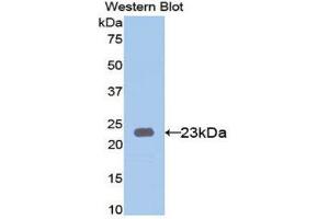 Western Blotting (WB) image for anti-Keratin 23 (KRT23) (AA 243-382) antibody (ABIN1171784) (KRT23 antibody  (AA 243-382))