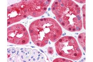 FAH antibody was used for immunohistochemistry at a concentration of 4-8 ug/ml. (FAH antibody)