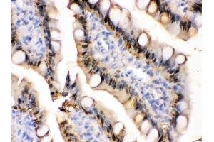 Anti- liver FABP Picoband antibody,IHC(P) IHC(P): Rat Intestine Tissue (FABP1 antibody  (N-Term))