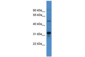 Image no. 1 for anti-Transmembrane Protein 176B (TMEM176B) (C-Term) antibody (ABIN6745490) (TMEM176B antibody  (C-Term))