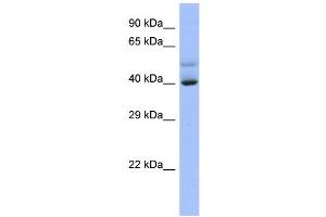 Host:  Rabbit  Target Name:  SCML4  Sample Type:  NCI-H226 Whole cell lysates  Antibody Dilution:  1. (SCML4 antibody  (C-Term))