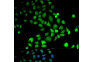 Immunofluorescence analysis of U2OS cells using PARN Polyclonal Antibody (PARN antibody)