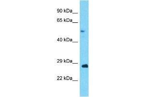 Host:  Rabbit  Target Name:  ANAPC5  Sample Type:  Ovary Tumor lysates  Antibody Dilution:  1.