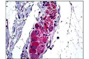 Human Intestine, Ganglion Cells: Formalin-Fixed, Paraffin-Embedded (FFPE) (HDAC6 antibody  (N-Term))