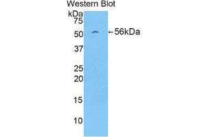 Western Blotting (WB) image for anti-Protein L-Myc (MYCL) (AA 186-439) antibody (ABIN1859918) (LMYC antibody  (AA 186-439))