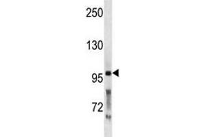 PCSK5 antibody western blot analysis in WiDr lysate. (PCSK5 antibody  (AA 95-124))