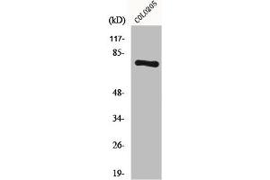 Western Blot analysis of COLO205 cells using HLX1 Polyclonal Antibody (HLX antibody  (C-Term))