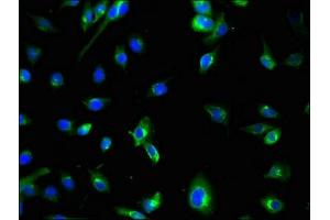 Immunofluorescent analysis of U251 cells using ABIN7174538 at dilution of 1:100 and Alexa Fluor 488-congugated AffiniPure Goat Anti-Rabbit IgG(H+L) (ATG7 antibody  (AA 386-676))