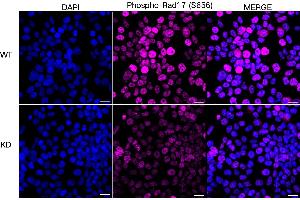 Immunocytochemical staining of HeLa cells using Phospho-Rad17 (S656) antibody (ABIN7800113), 1:1,000), Top panel: wild-type (WT), Bottom panal: Phospho-Rad17 (S656) shRNA knockdown (KD). (Recombinant RAD17 antibody  (pSer656))