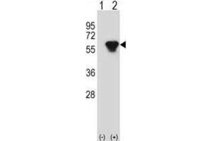 Western Blotting (WB) image for anti-Protein Kinase, CAMP-Dependent, Regulatory, Type II, beta (PRKAR2B) antibody (ABIN2998379) (PRKAR2B antibody)
