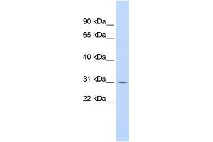 Western Blotting (WB) image for anti-Nuclear Factor of kappa Light Polypeptide Gene Enhancer in B-Cells Inhibitor, alpha (NFKBIA) (N-Term) antibody (ABIN926864)