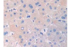 Used in DAB staining on fromalin fixed paraffin- embedded kidney tissue (IL3RA antibody  (AA 19-158))