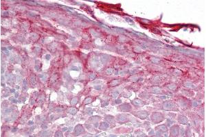 Immunohistochemistry with Tonsil tissue at an antibody concentration of 5µg/ml using anti-CFP antibody (ARP56381_P050) (CFP antibody  (N-Term))