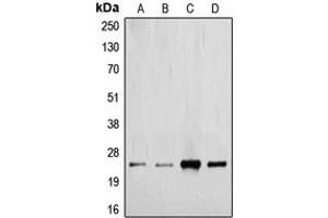 Western blot analysis of TGF beta 2 expression in MCF7 (A), HeLa (B), mouse kidney (C), rat placenta (D) whole cell lysates. (TGFB2 antibody  (C-Term))