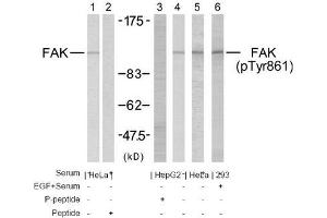 Image no. 2 for anti-PTK2 Protein tyrosine Kinase 2 (PTK2) (Tyr861) antibody (ABIN197235) (FAK antibody  (Tyr861))