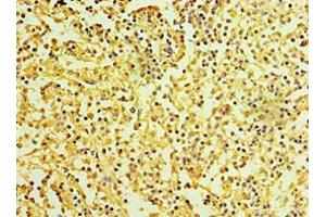Immunohistochemistry of paraffin-embedded human spleen tissue using ABIN7156877 at dilution of 1:100 (IL27 Receptor alpha antibody  (AA 33-283))