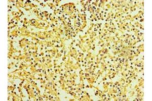 Immunohistochemistry of paraffin-embedded human spleen tissue using ABIN7156877 at dilution of 1:100