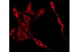 ABIN6276245 staining HeLa by IF/ICC. (OR10R2 antibody  (C-Term))